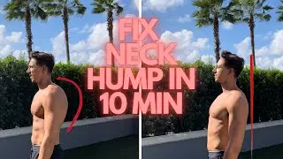 QUICK 10 MIN fix for Neck Hump| Get Rid of a Neck Hump |Home Exercises #fast #exercises #neckhump