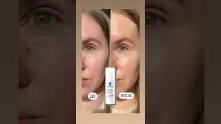 Уход + коррекция тона для кожи с розацеа❤️ Обзоры на аптечную косметику @cosmetist