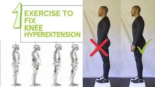 Knee Hyperextension (Fix Hyperextended Knees)