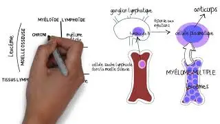 Comprendre le myélome multiple