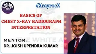 BASICS OF CHEST XRAY RADIOGRAPH INTERPRETATION