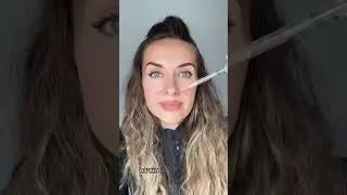 Никогда не колите филлер в эти зоны носогубки! 