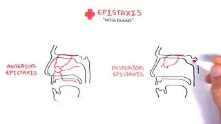 Clinical Anatomy -  Nasal Cavity and Nose bleeds