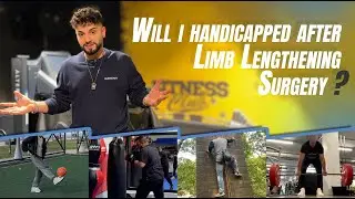 WILL I HANDICAPPED AFTER LIMB LENGTHENING SURGERY?