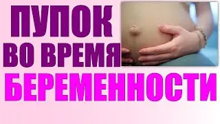 ПУПОК ВО ВРЕМЯ БЕРЕМЕННОСТИ | Почему при беременности пупок может вылезать и темнеть