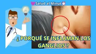 PORQUE SE INFLAMAN LOS GANGLIOS LINFATICOS Y COMO DETECTARLOS A TIEMPO