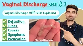 Vaginal Discharge Explained | Types, Causes, Symptoms And Prevention of Abnormal Vaginal Discharge