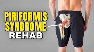 4 Rehab Exercises for Piriformis Syndrome (Deep Gluteal Pain Syndrome)