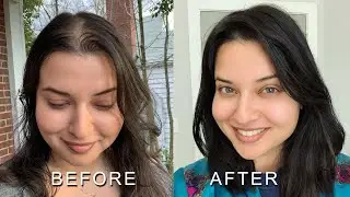 Hair Topper| Reviewing Claire Human Hair Topper & How To Wear