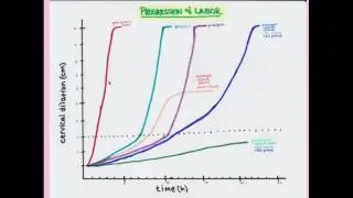 Abnormal Labor and Delivery - CRASH! Medical Review Series