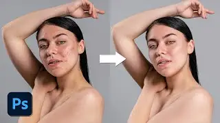 Quickest way to Retouch Skin in Photoshop