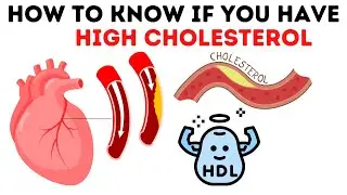 High cholesterol symptoms causes and treatment | Signs of high cholesterol in Hindi