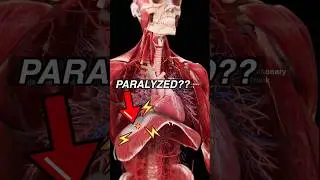 Doctor explains ALS in 60 seconds 