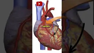 Heart Bypass Surgery Explained | A Simple Overview #hearthealth #heartdisease