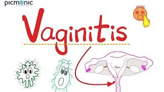 Vaginitis - Bacterial vaginosis, Trichomonas vaginitis, Candida vulvovaginitis - Picmonic Micro(#15)