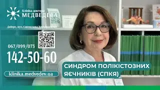 Синдром полікістозних яєчників