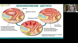 Основные возбудители цистита