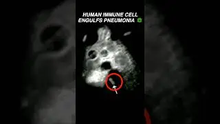 Human Neutrophil ENGULFS Pneumonia Bacteria 