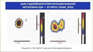 Круглый стол Белорусского общества эндокринологов в рамках областного научно-практического семинара