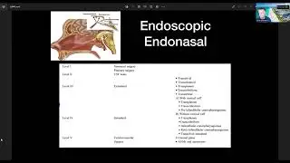 Extended Endoscopic Endonasal Approach For Clival Chordoma - Professor Selfy Oswari