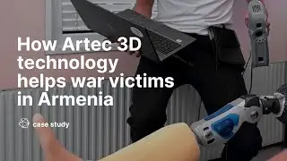 How Artec 3D technology helps war victims in Armenia