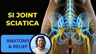 Sciatica from SI Joint Pain | Anatomy and Relief