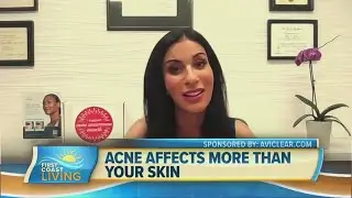 Hope for acne sufferers