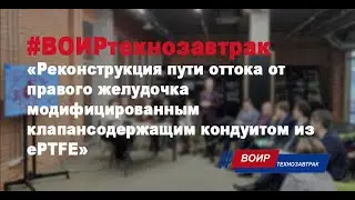 Реконструкция пути оттока от правого желудочка модифицированным клапансодержащим кондуитом