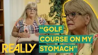 Woman With SIX Bellybuttons Finally Gets Surgery | Botched Bariatrics