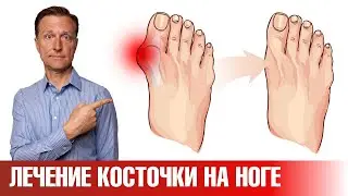 Эти 5 упражнений помогут убрать косточку на большом пальце ноги✅