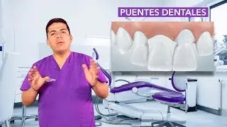 🚨¿Qué es un PUENTE DENTAL? 🧐