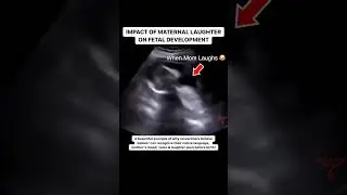 Effect of a Mother's Laughter on an Unborn Baby