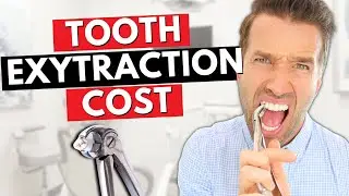 Cost of a Tooth Extraction | Teeth Extractions