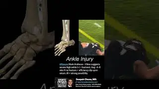 Mark Andrews SEVERE Ankle Injury | Doctor Explains