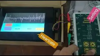 ECG Arduino Module Robotdyn #ecg #arduinoproject