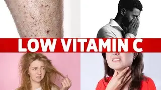 8 Signs of a Vitamin C Deficiency You've Never Heard About