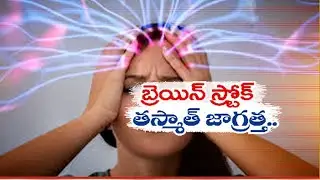 How to Identify Symptoms of Brain Stroke ? | బ్రెయిన్‍ స్ట్రోక్‍ను ఎలా గుర్తించాలి ? || Idi Sangathi