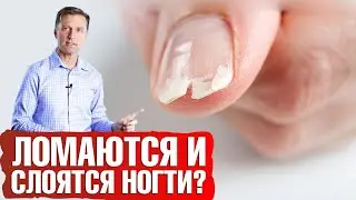 Ломаются и слоятся ногти? Как укрепить ногти🤔