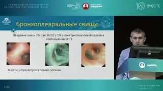 Интервенции в трахеобронхиальном дереве - что, где и как