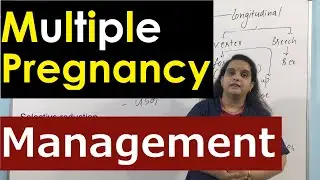 Management of the Multiple Pregnancy | Management in Pregnancy, Labour & Postnatal Period