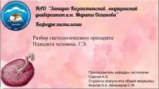 Разбор гистологического препарата: Плацента человека. Г.Э.