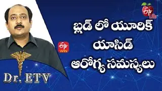 High Uric Acid Level - Causes | బ్లడ్ లో యూరిక్ యాసిడ్ – ఆరోగ్య సమస్యలు | Dr.ETV | 7th July 2022