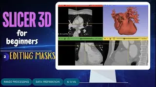 Edit Segmentation Mask in Slicer 3D