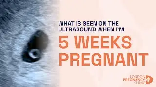 What would an ultrasound show at 5 weeks of pregnancy? A London Pregnancy Clinic case study