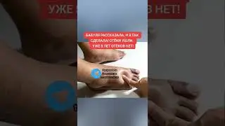 бабуля рассказала, а я так сделала, отёки ушли, уже 5 лет ОТЁКОВ НЕТ #здоровье #зож #медицина