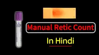 Reticulocyte count in hindi || Manual retic count - Principle , procedure & interpretation