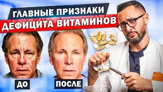 Внешние проявления недостатка витаминов. Витамины A, C, B, D, E, K