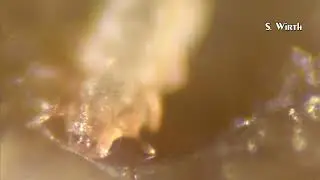 Complex and modified mouthparts in Histiostomatidae mites (4K)