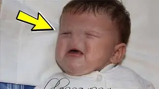 Born without a leg, mouth and nose. This is how the boy’s fate turned out after 9 years!