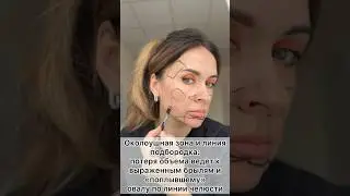 Как стареет череп и как это проявляется #морщины #омоложение #пилинг #уколыкрасоты #ботокс #губы